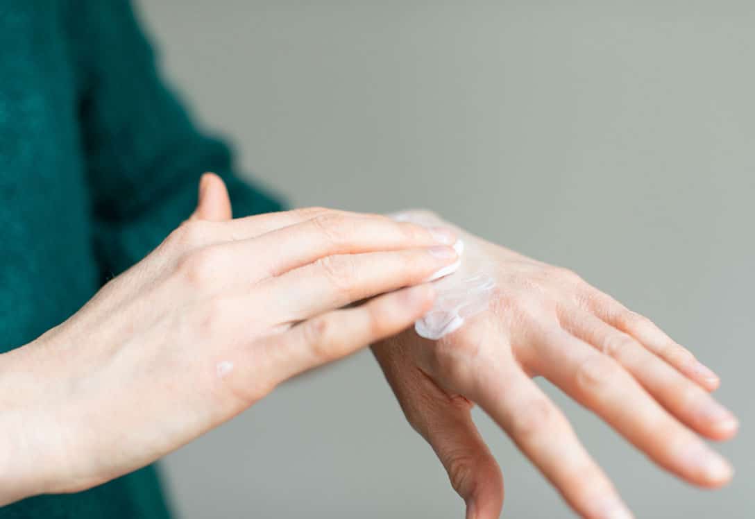 como-combatir-sabanones-1 Manos dándose crema contra los sabañones