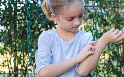 Dermatitis atópica durante la infancia