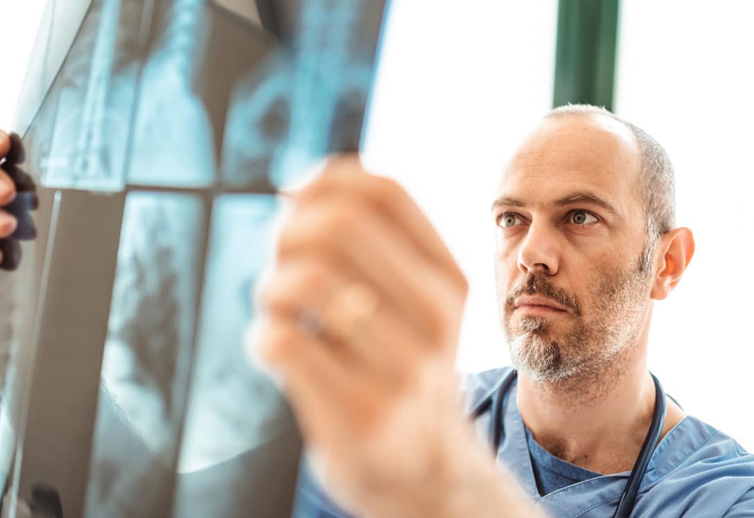 Hombre observando radiografía de fibrosis pulmonar