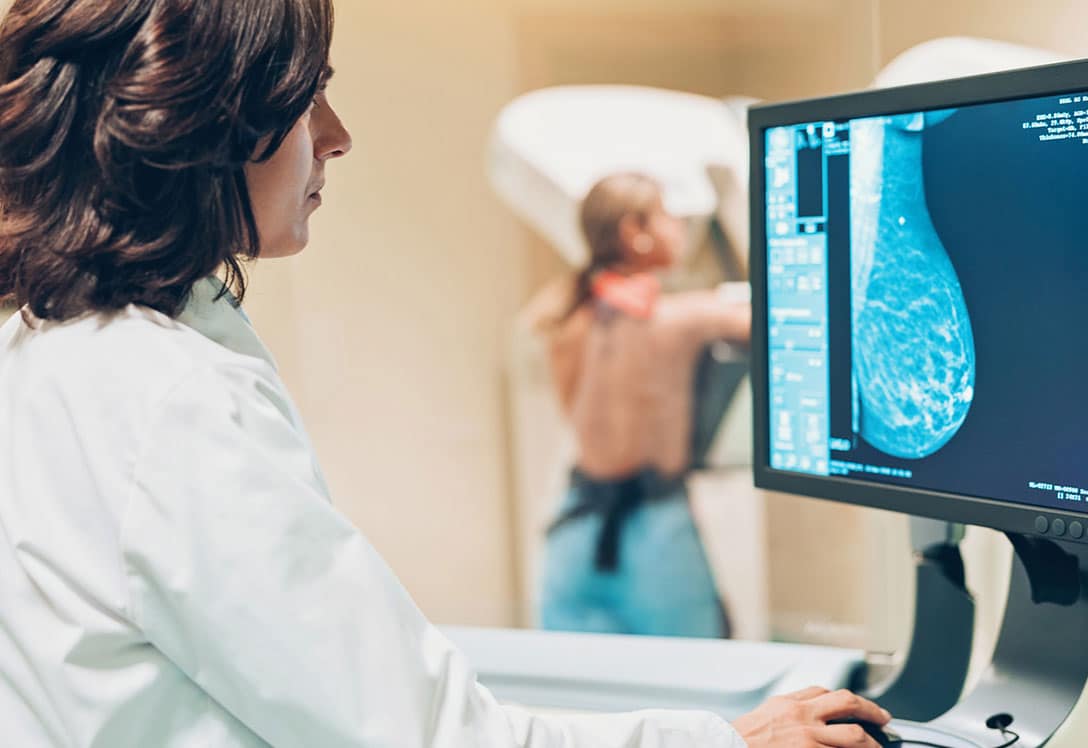 que-cirugia-necesito-1 Cirugía para el cáncer de mama