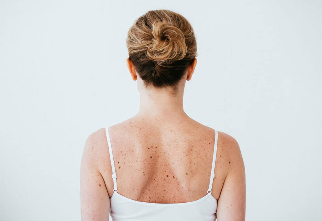 mujer de espaldas con pelo recogido