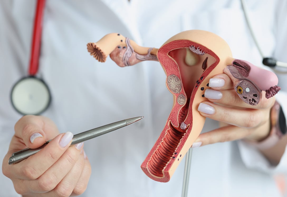 Médico explicando enfermedad fibromas en el útero