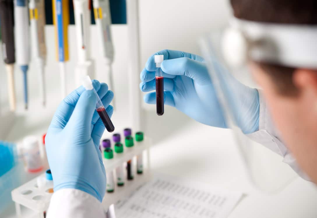 Análisis de muestras de sangre en un laboratorio