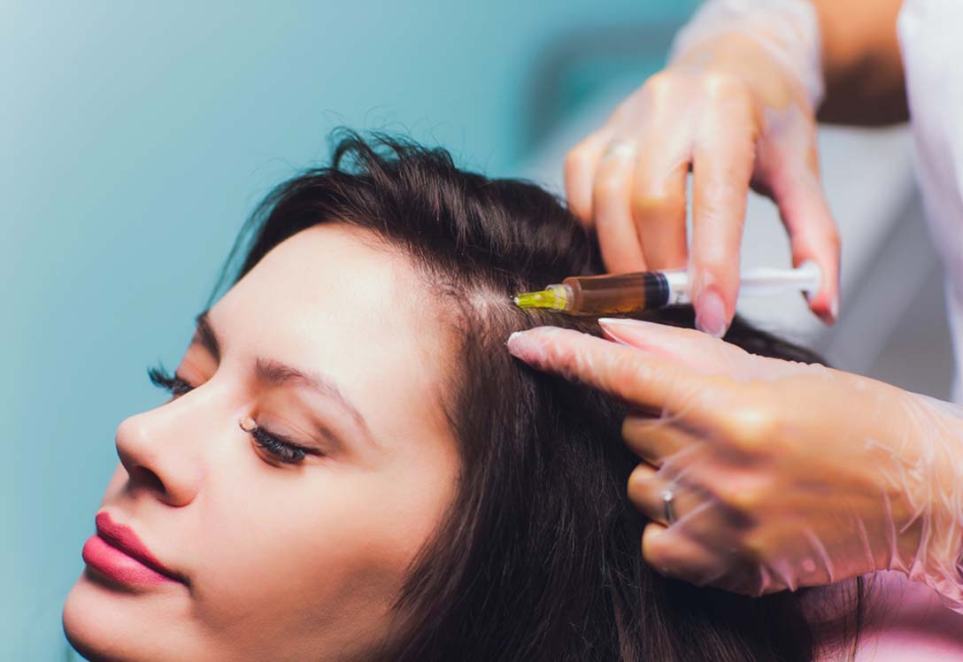 Mujer recibiendo tratamiento contra caída del cabello