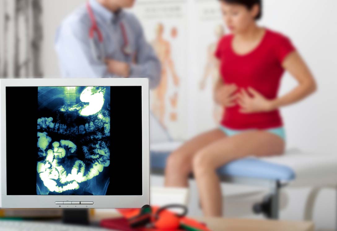 revision-medica-estomago Revisión médica del sistema digestivo