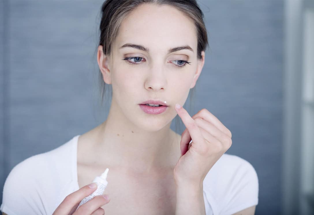tratamiento-herpes-labial Tratamiento de herpes labial